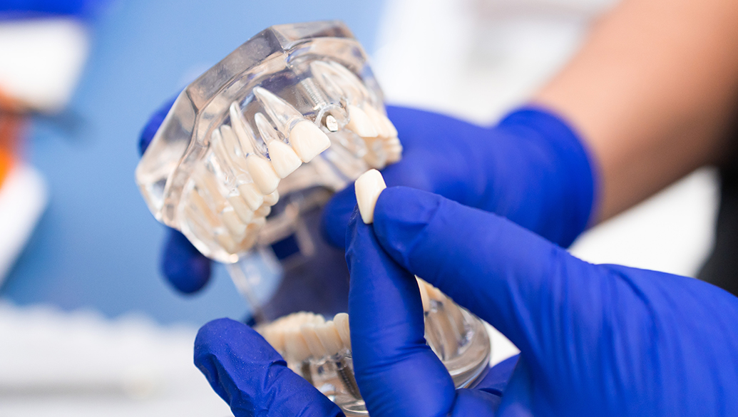 Treatment inner thumb : Ibbott