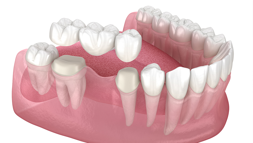 Treatment inner thumb : Ibbott