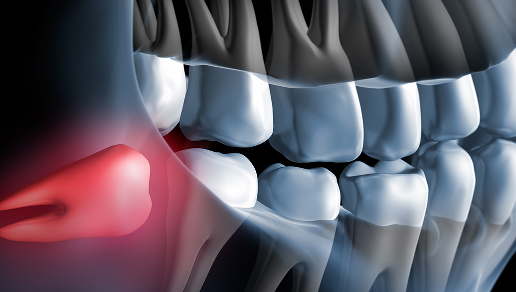 Treatment inner thumb : Ibbott