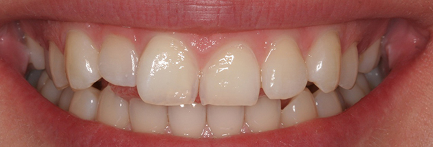 Before - Ibbott Dental