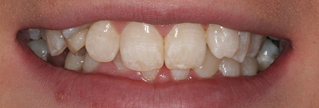 Before - Ibbott Dental